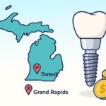Cost Of Dental Implants In Michigan