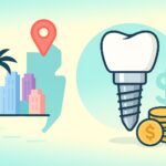 Cost Of Dental Implants Miami