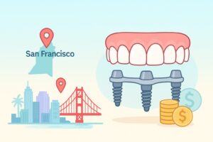 Cost Of Full Mouth Dental Implants San Francisco, CA