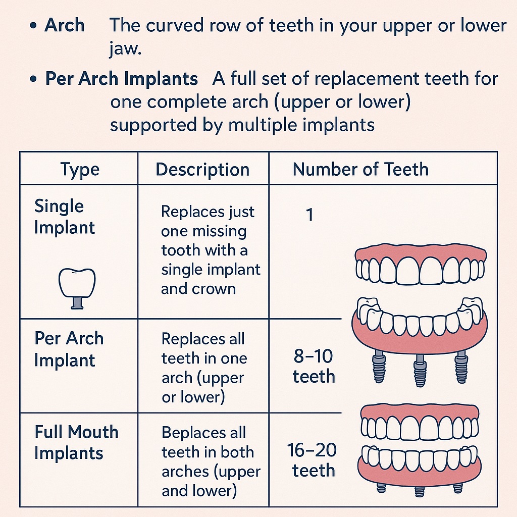 What Does “Per Arch” Mean in Dental Implant Treatment