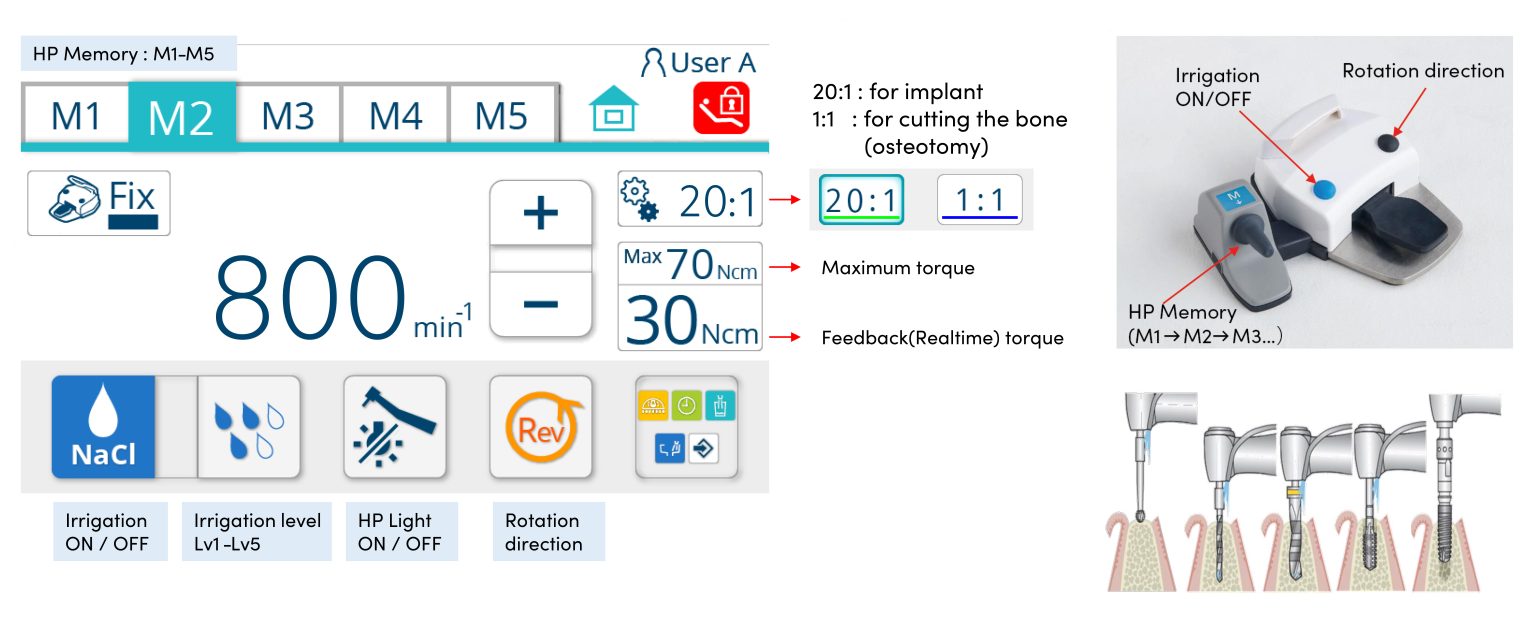 Belmont Eurus  New Implantology Motor System