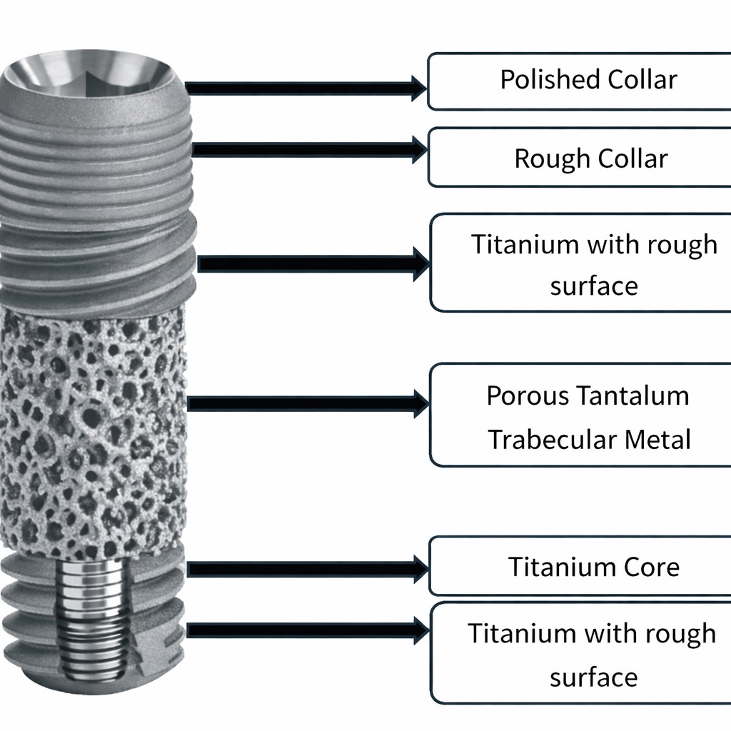Tantalum Dental Implants 1