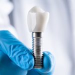 What Should You Know About Dental Implants Annandale?